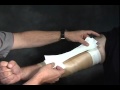Protective Taping of the Elbow