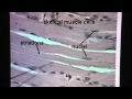 Skeletal Muscle Tissue